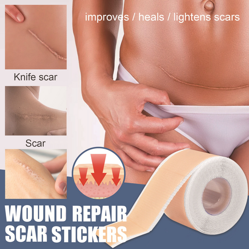 Comfort Silicone Scar Tape | Luveria